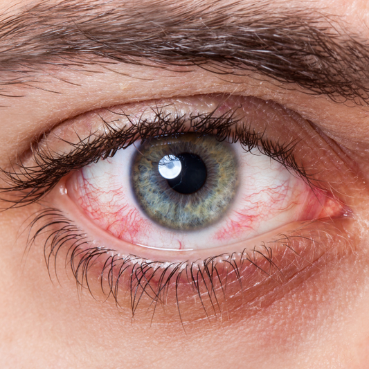 How Foods Support Your Lymphatic & Eye Health