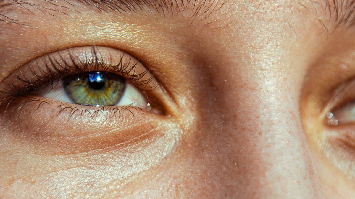 30yr_old_tired_eyes_zoomed_in_image_of_one_eye_and_nose._Slightly_smaller_tired_eye.